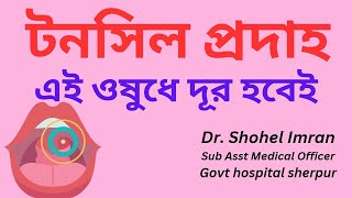 Tonsilitis active treatment Tonsil betha valo korar upay গলা ব্যথার ওষুধ টনসিল হলে করনীয় কি টনসি [upl. by Namya875]