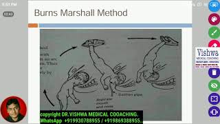 Burn marshalls maneuver for breech presentation BY DRVISHWA MEDICAL COACHING WHATSAPP 919930788955 [upl. by Sander]