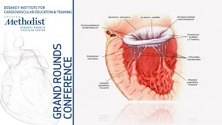 Mitral Valve Regurgitation Evolving Concepts in Diagnosis Prognosis amp Mgmt Zoghbi MD 091219 [upl. by Marler]