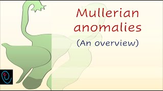 Mullerian anomalies  an overview [upl. by Isma860]