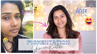 How I Controlled the Pigmentation around my mouth Causes Skincare Treatment  Femirelle [upl. by Irisa571]