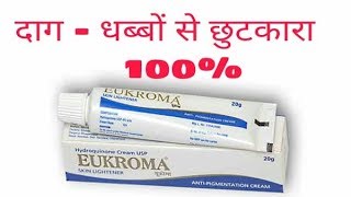 How To Remove Melasma  Hyperpigmentation  Eukroma cream uses sideeffects price review in hind [upl. by Dinnie]