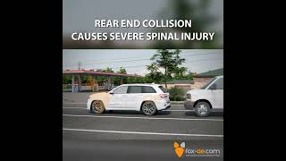 Rear End Collision Causes Severe Spinal Injury [upl. by Yroj]