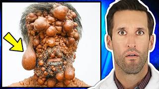 ER Doctor REACTS to Worlds Rarest Diseases PART 2 [upl. by Winther]