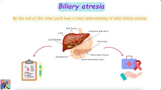 Understanding Biliary Atresia – Causes Diagnosis and Treatment [upl. by Nileuqaj]