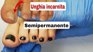 Pedicure unghie incarnite semipermanente [upl. by Annoek]