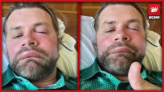 Brian McFadden Fans Concerned Over Botox Videos [upl. by Bazil]