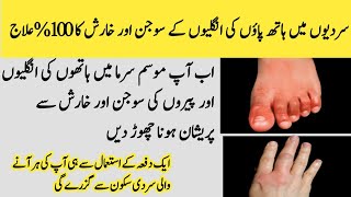 chilblains treatment at home  itchy swollen toes  sardi mein paon ki sujan ka ilaj [upl. by Neelyaj]