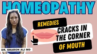 Homeopathy Remedies for Angular Stomatitis  Dr Sharon Ali MD [upl. by Eseila]