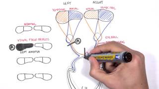 Visual Pathway and Lesions [upl. by Reiser143]