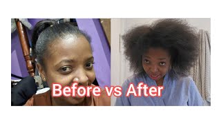 MY NATURAL HAIR CARE ROUTINE🤗UNDOING MY ARTIFICIAL DREADLOCKSBEFORE VS AFTER ARTIFICIAL LOCKS [upl. by Shanie]