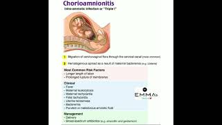 💠 Chorioamnionitis 💠 [upl. by Elinad401]