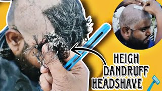 Most attractive dandruff HeadShave 🪒 [upl. by Ellemac25]