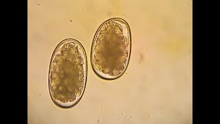 Hookworms in dogs  Ancylostoma caninum Flotation method [upl. by Len]