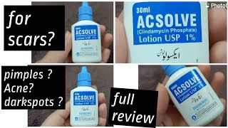 ACSOLVE lotion Review [upl. by Cyrano]