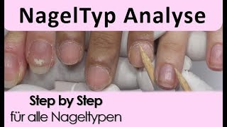 Nagelmodellage  Nagel Typ Analyse [upl. by Linder]