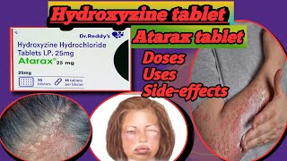 Atarax tablet Hydroxyzine  Hydroxyzine hydrochloride  Atarax 25 mg  Hicope 25 tablet [upl. by Deerdre445]