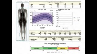 Bone Density Scanning and Results Score Analysis [upl. by Innos]