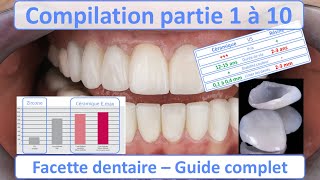 Facette Dentaire  Présentation par le Dr Martine Zisserman [upl. by Craig182]