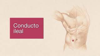 Información Sobre su Urostomía Hollister [upl. by Ralli]