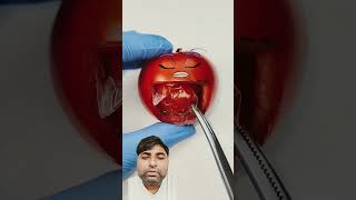 Food Surgery Apple banana tamato avacado gsviral funny comedy fun [upl. by Ennovehs]