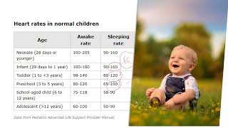 CSCWebinar 016 Les tachycardies à QRS large enfant et adulte [upl. by Joli]