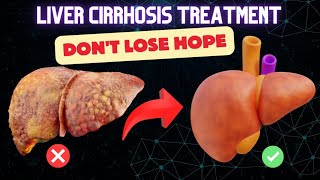 Liver cirrhosis treatment and cure Get your liver back to normal [upl. by Tennes]