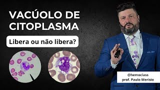 Vacúolo de citoplasma Libera ou não libera [upl. by Herzen116]