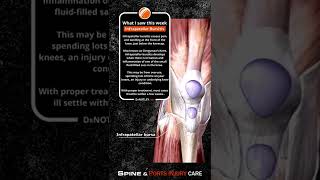 Infrapatellar bursitis  Dr Notley Chiropractor and Athletic Therapist in Winnipeg [upl. by Yahc86]