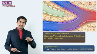 2Edema Pathogenesis  Hemodynamic pathology Fmge amp Neet PG [upl. by Eberto832]