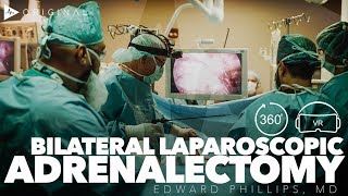 Teaching Bilateral Laparoscopic Posterior Adrenalectomy  Dr Edward H Phillips [upl. by Aspasia]