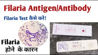 microfilaria antibody test I filaria antigen test [upl. by Irafat]