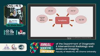 MRI in arrhythmia and recurrent syncope [upl. by Abbi]