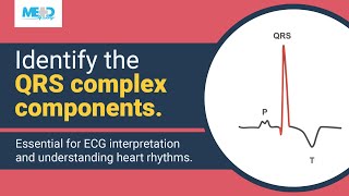 Identifying components of the QRS complex [upl. by Anelis345]