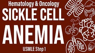 Sickle Cell Anemia HemeOnc  USMLE Step 1 [upl. by Scoville270]