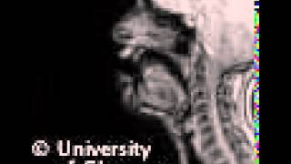 MRI voiced alveolar approximant [upl. by Lebatsirc]