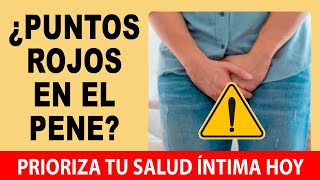 Puntos Rojos En El Glande 💥 Soluciones Efectivas Guía Práctica Sobre La Balanitis [upl. by Atnod]