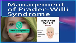 🔴What Is PraderWilli Syndrome ❓He also may have these symptoms👀👀 [upl. by Madge]