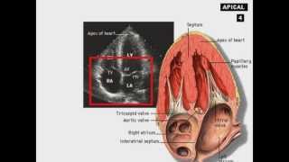 Echocardiography Introduction [upl. by Lliw]