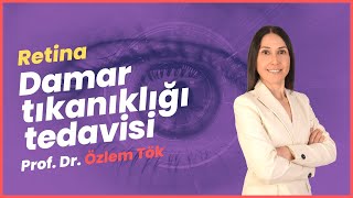 Retina Damar Tıkanıklığı Tedavisi Nasıldır Prof Dr Özlem Tök [upl. by Nilat]