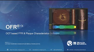 OFR OCTbased FFR amp Plaque Characteristics OctPlus  Pulse Medical [upl. by Grath]