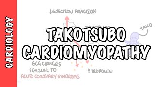 Clinical Anatomy  Cardiac Coronary Vessels left and right coronary artery venous sinus [upl. by Mukerji918]