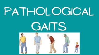 PATHOLOGICAL  ABNORMAL GAITS PART1 PRACTICAL DEMONSTRATION IN URDU  HINDI [upl. by Eseilana39]