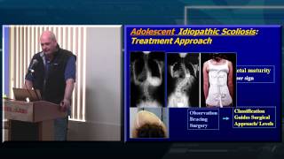 Decision Making in Adult Spinal Deformity [upl. by Alpheus]