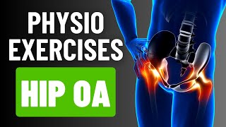 Manage Your Hip Osteoarthritis Best Exercises [upl. by Lisab88]