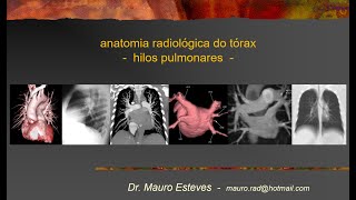 Anatomia  Hilos pulmonares [upl. by Llarret]