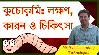 Pinworm Symptoms Cause amp Treatment  কুচোকৃমি বা গুড়োকৃমি লক্ষণ কারন ও চিকিৎসা। [upl. by Forest]