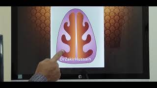 Nasal turbinate hypertrophy Part 1 Malayalam Patient teaching [upl. by Ardni932]