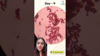 Welcome to today’s Micro Mystery  Can you crack this case  Day 9  Dr Devyani Puri [upl. by Noble]