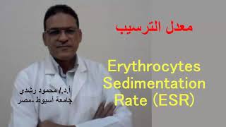 Erythrocytes Sedimentation rate ESR  معدل ترسيب خلايا الدم الحمراء [upl. by Milford]